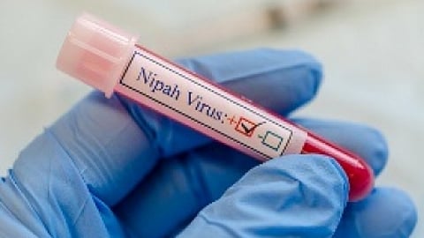 தமிழகத்தில் நிபா வைரஸ் பாதிப்பு இல்லை -பொது சுகாதாரத் துறை இயக்குநா் செல்வவிநாயகம்