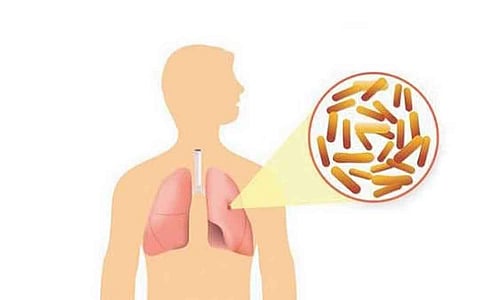 கோப்புப்படம்.