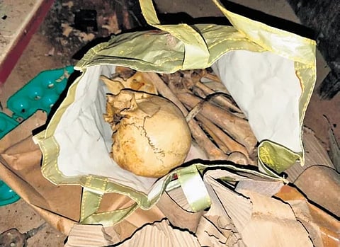 மீட்கப்பட்ட மண்டை ஓடு, எலும்புகள்.