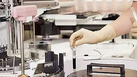 பிரதிப் படம்