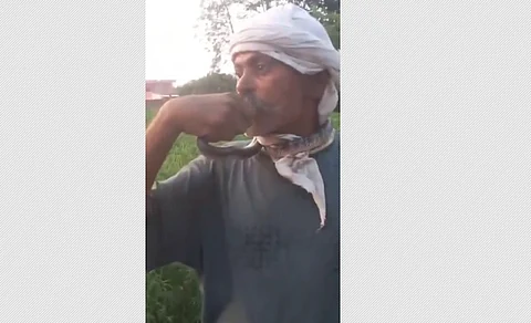snake bite