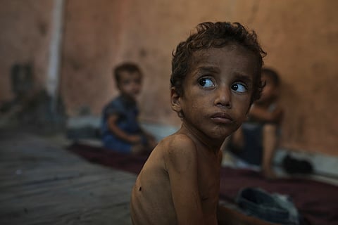 Starving Gaza children too weak to cry