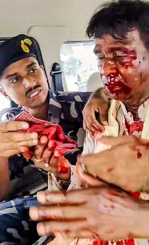 ரத்தக் காயங்களுடன் மீட்கப்பட்ட பாஜக எம்.பி. ககன் முா்மு.