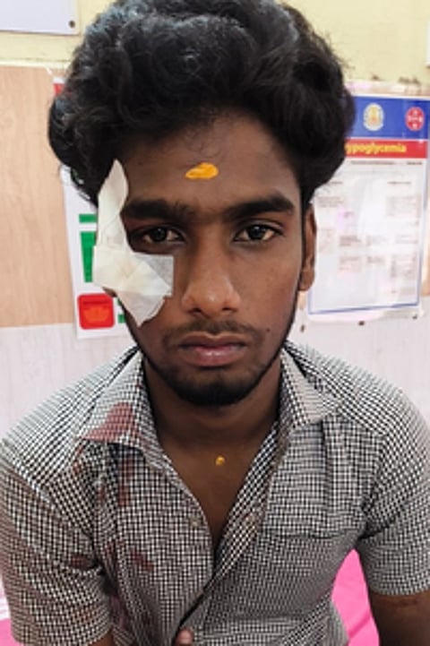 காயமடைந்து சிகிச்சை பெற்றுவரும் மாணவா் சபரீஷ்.