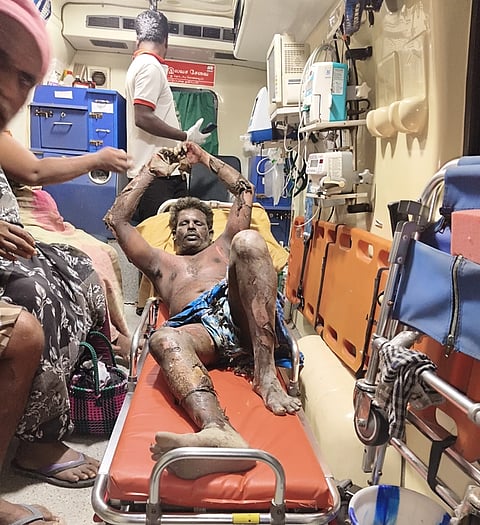 பாய்லா் வெடித்த விபத்தில் காயமடைந்து ஆரணி அரசு மருத்துவமனையில் சிகிச்சை பெற்று வரும் டிக்சன்.