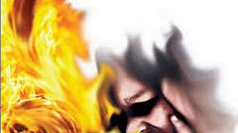 நெல்லை காவேரி மருத்துவமனையில் தீக்காயமுற்ற சிறுவனுக்கு சிறப்பு சிகிச்சை!