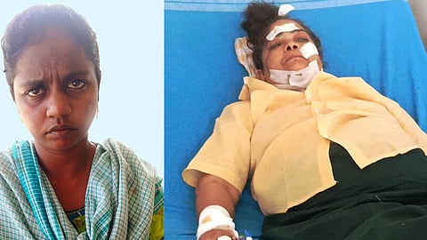 பவித்ரா, சிகிச்சை பெறும் ஷியமாலா.