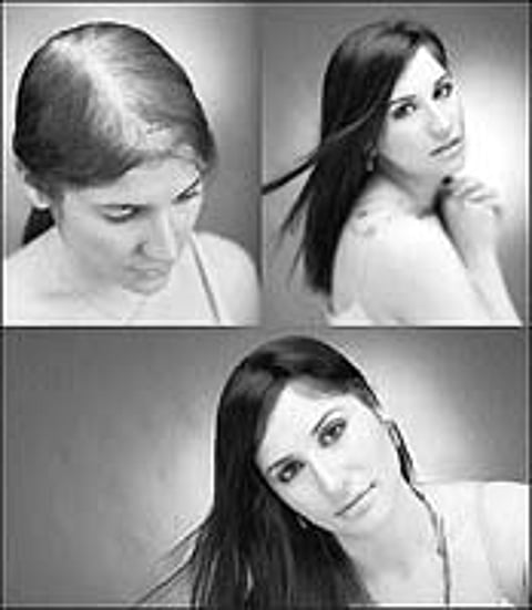 ஆயுள் காக்கும் ஆயுர்வேதம்: "முடி'யும் வளரும்!