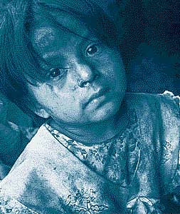 புதுவையில் ஊட்டச்சத்து குறைபாடு குழந்தைகள் 11 ஆயிரம்