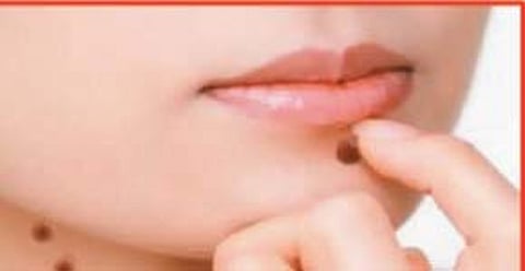 ஆயுள் காக்கும் ஆயுர்வேதம்: கழுத்தைச் சுற்றிலும் மரு... வறண்ட தோல்...என்ன செய்யலாம்?