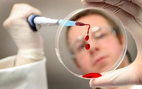 நாக்பூரில் மூன்று நாள்களில் 21 பேருக்கு பன்றிக் காய்ச்சல்