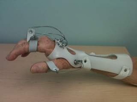 15.நரம்பு பாதிப்புகள்