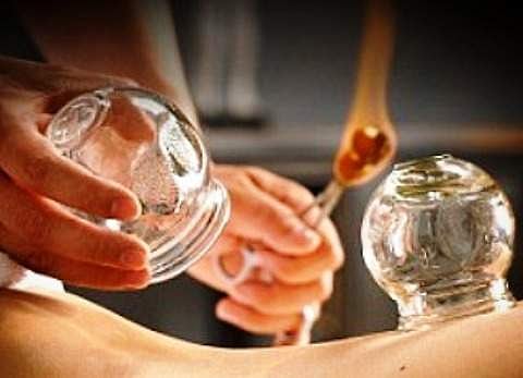 கப்பிங் தெரப்பி: இது ஒரு மாறுபட்ட சிகிச்சை முறை!