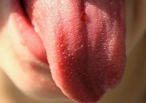 வரதட்சணைக்கான சண்டையில் எதிர்த்துப் பேசிய மனைவியின் நாக்கை அறுத்து கணவன் கொடூரம்!