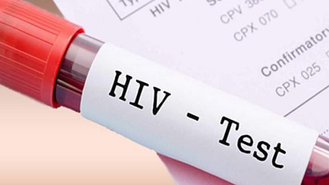 ஆறு ஆண்டுகளில் ஹெச்ஐவியை முழுமையாக ஒழிக்க இலக்கு -மக்கள் நல்வாழ்வுத் துறைச் செயலா்