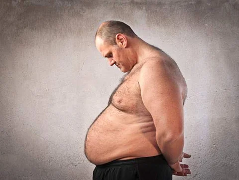 Enlarged breasts in men is gynecomastia
