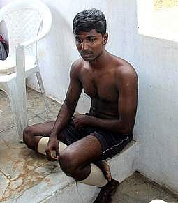 இரண்டாம் நிலை காவலா் தோ்வில் தலையில் பபுள்கம் வைத்துக் கொண்டு வந்த தயாநிதி.