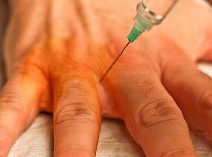 மயக்க மருந்தை உடலில் செலுத்தி பெண் மருத்துவர் தற்கொலை