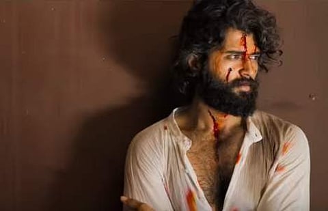 அதீதக் கோபக்காரராகவே தோன்றும் அர்ஜுன் ரெட்டி நடிகர்!