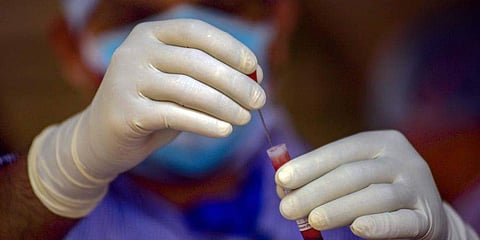 தமிழகத்தில் புதிதாக 54 பேருக்கு கரோனா; பாதிப்பு 1,683 ஆக அதிகரித்தது!