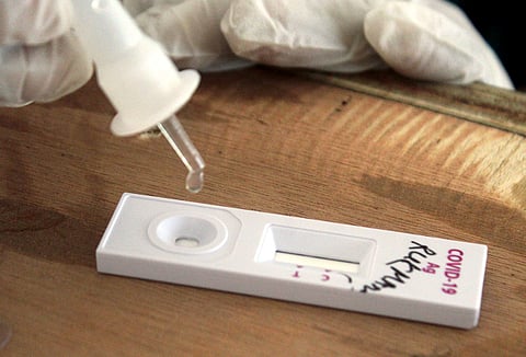 தமிழகத்தில் இன்று (சனிக்கிழமை) புதிதாக 3,713 பேருக்கு கரோனா வைரஸ் நோய்த் தொற்று இருப்பது உறுதி செய்யப்பட்டுள்ளது. (கோப்புப்படம்)