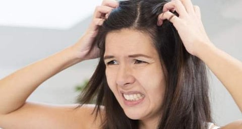 Do this to get rid of lice and dandruff