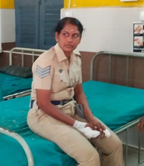 காயமடைந்த பெண் காவலா் மஞ்சுளா.