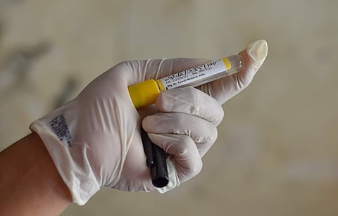 சிங்கப்பூரில் வெளிநாட்டிலிருந்து வந்தவர்களால் கரோனா அதிகரிப்பு