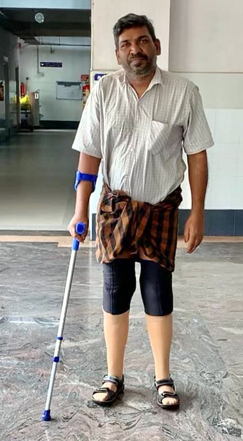 செயற்கை கால்கள் பொருத்தப்பட்ட சின்னசாமி.