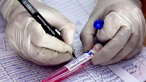 ஜிபிஎஸ் நோயால் மேலும் ஒருவர் உயிரிழப்பு..!