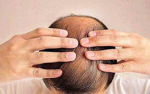 ஆயுள் காக்கும் ஆயுர்வேதம்: தலையில் அரிப்பு, எரிச்சல் குறைய...!