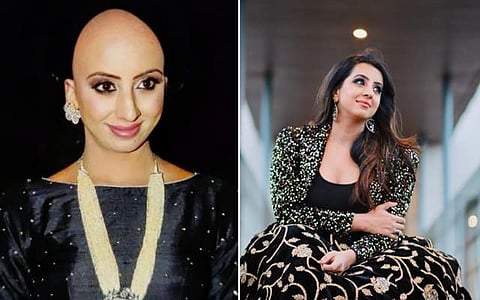 மொட்டைத் தலையுடன் இருக்கும் படத்தை பகிர்ந்து அதிர்ச்சியளித்த நடிகை - என்ன ஆனது ?