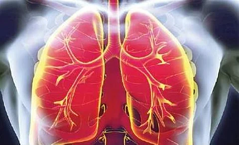 தமிழகத்தில் நிகழாண்டில் 34,239 பேருக்கு காசநோய் பாதிப்பு