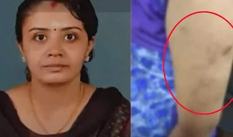 கொச்சி அருகே சிறுநீர் குடிக்க வைத்து சிறுமி சித்ரவதை: சித்தி கைது