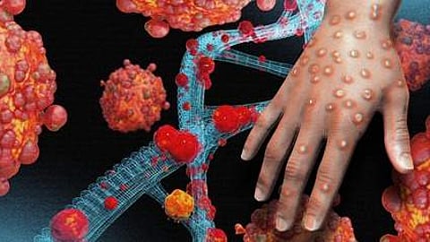 mpox