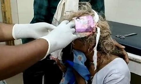 இதுதான் அலட்சியத்தின் உச்சமா..? தலையில் அடிப்பட்ட பெண்ணுக்கு ஆணுறை வைத்து கட்டுப்போட்ட அவலம்!