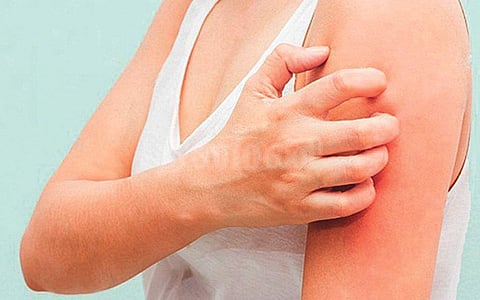 ஆயுள் காக்கும் ஆயுர்வேதம்: உடல் எரிச்சல் குணமடைய?