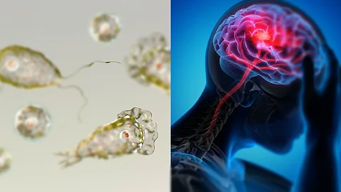 brain-eating amoeba