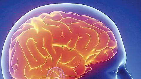 மறதிக்கு மருந்து...