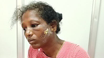 மணப்பாறை அரசு மருத்துவமனையில் சிகிச்சை பெற்று வரும் சரோஜா.