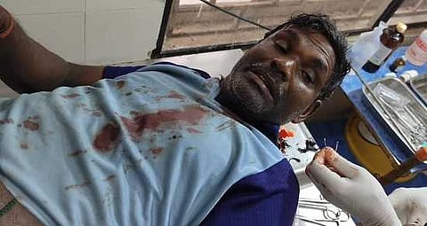 தாக்குதலில் காயமடைந்த மீனவா்கள்.