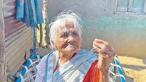 கிராமவாசிகள் சிலருக்கு வழக்கத்தை விட அதிகமான தலைமுடி உதிர்ந்து, வழுக்கையாகும் நிலை ஏற்பட்டுள்ளது