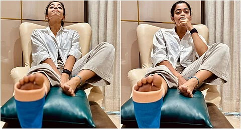காலில் காயம்! ராஷ்மிகாவால் படப்பிடிப்புகள் பாதிப்பு!