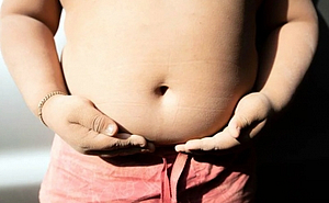 child obesity