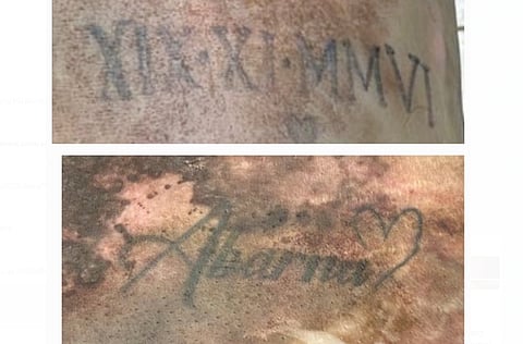 ஆண் சடலத்தின் உடலில் பச்சைக் குத்திய புகைப்படங்கள்