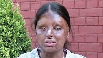 ஆச்சரியம், வித்தியாசம்...