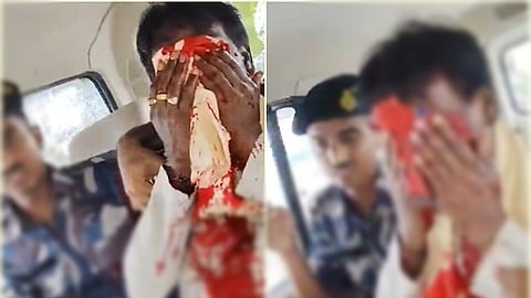 பாஜகவைச் சேர்ந்த எம்.பி. காகென் முர்மு மற்றும் எம்எல்ஏ சங்கர் கோஷ் ஆகிய இருவர் மீது தாக்குதல்
