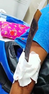 கீா்த்திகாவின் கையில் குத்தப்பட்டுள்ள கத்தி.