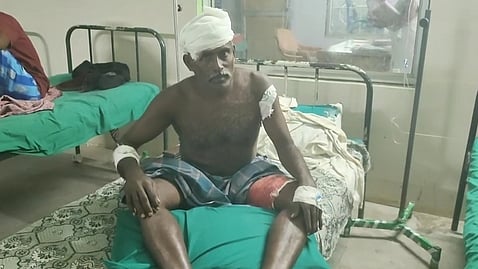  காயமடைந்த விவசாயி மைக்கேல் ஜெயசீலன்.