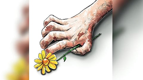 சென்னையில் குழந்தைகளிடையே அதிகரிக்கும் தொழுநோய் பாதிப்பு: பொது சுகாதாரத் துறை ஆய்வில் தகவல்